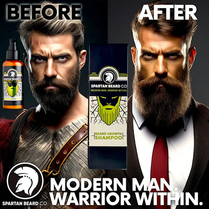 𝗦𝗣𝗔𝗥𝗧𝗔𝗡 𝗕𝗘𝗔𝗥𝗗™ Shampoo (80% OFF - First Order)